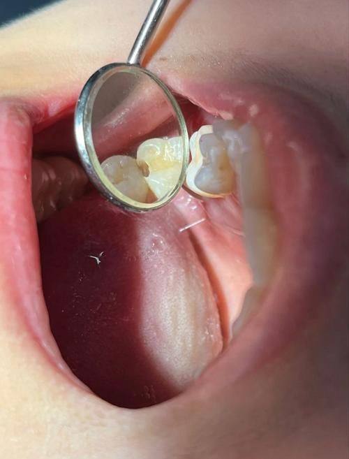 深圳龙普兰特口腔门诊部是正规医院吗？