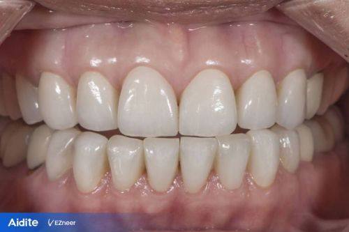 济南天真口腔诊所详细的预约挂号方式及流程