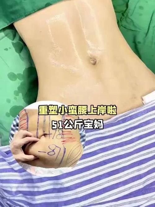 石家庄艾麦德医疗美容整形医院是正规医院吗？