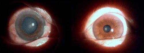 郑州博爱眼科中 心真人口碑评价怎么样?