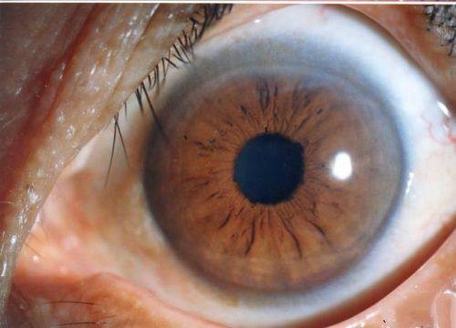 郑州博爱眼科中 心特色项目及技术优势