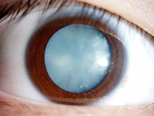 郑州博爱眼科中 心是正规医院吗?