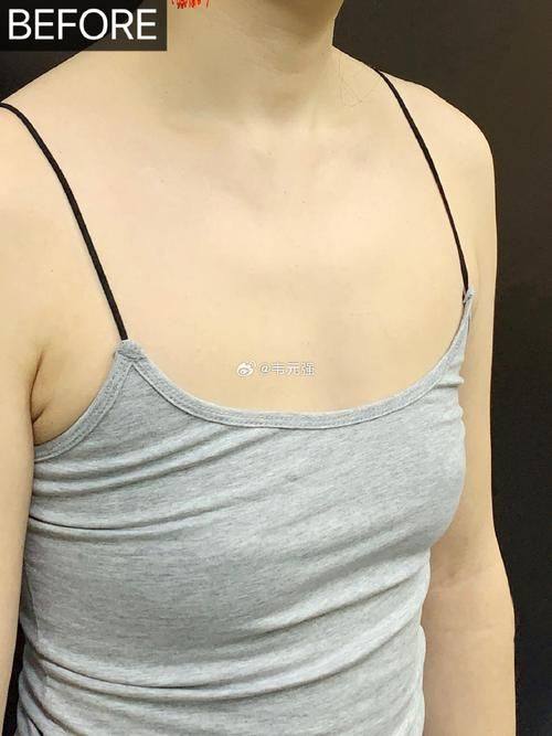 石家庄面容管家医疗美容真人口碑评价怎么样？