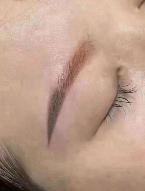 滕州艺美整形医院收费价格表/收费标准