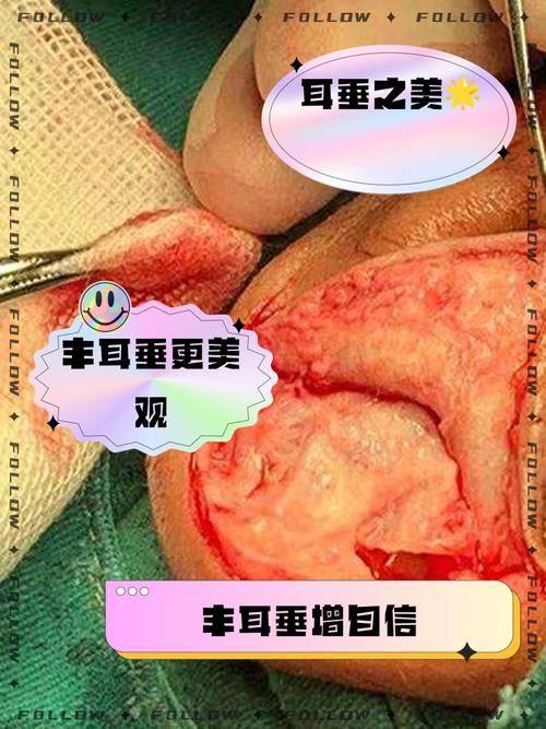 石家庄艾麦德医疗美容整形医院详细的预约挂号方式及流程