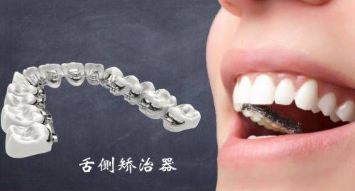 深圳龙普兰特口腔门诊部特色项目及技术优势