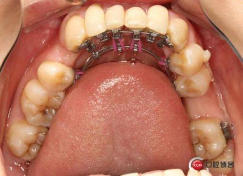 德州康贝佳口腔特色项目及技术优势