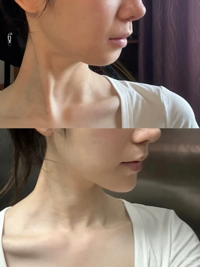 吴亮医生口碑评价及真人实例