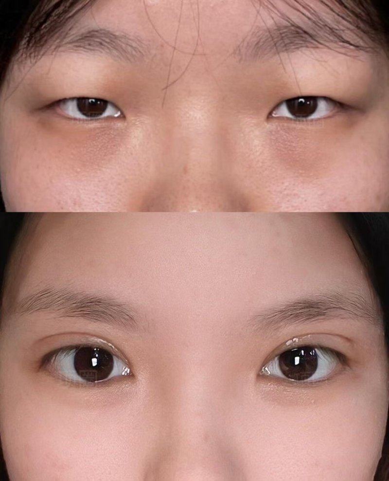 杨廷医生技术优势