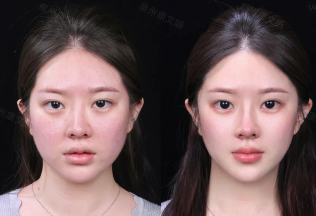 邱斌医生口碑评价及真人实例