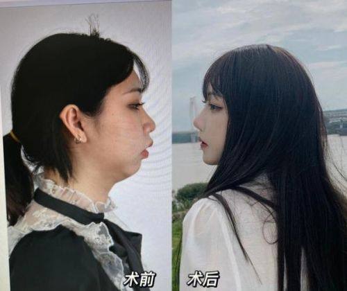 吴亮医生价格表