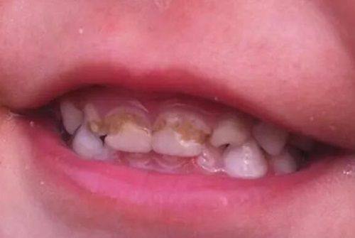 口碑评价及真人实例