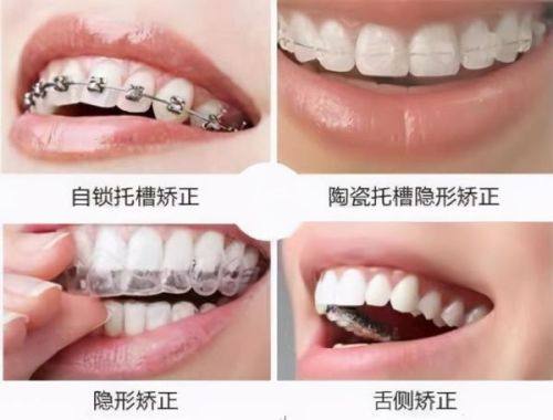 李嘉琪医生技术优势