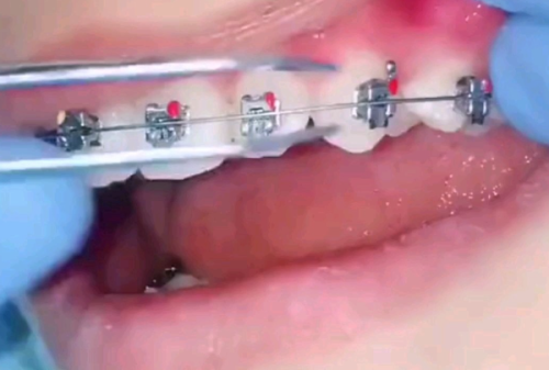 李嘉琪医生价格表