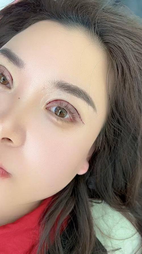 江门市中 心医院创伤烧伤整形科真人口碑评价怎么样？