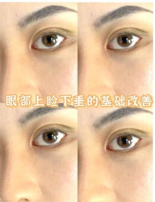 史冰心院长擅长项目