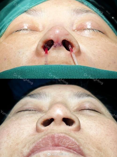 乌鲁木齐文艳医疗美容诊所是正规医院吗？