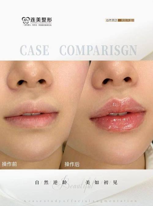 广州军区武汉总医院整形美容中 心是正规医院吗？