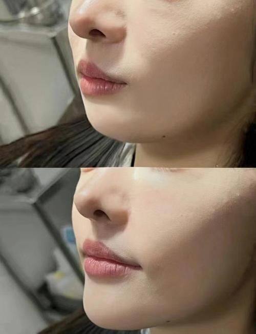 六安伊而美整形美容是正规医院吗？