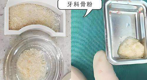 深圳牙博口腔门诊部