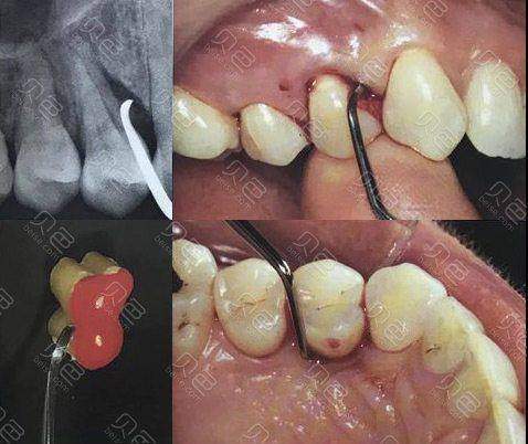 深圳牙博口腔门诊部地址电话营业时间