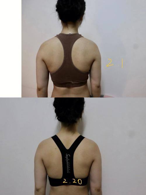 申琦医生口碑评价及真人实例