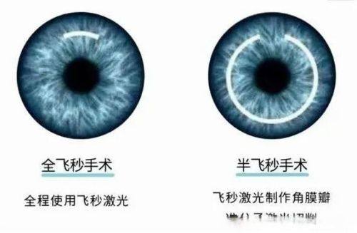 王洁月医生技术优势