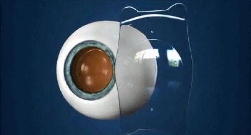 王洁月医生口碑评价及真人实例