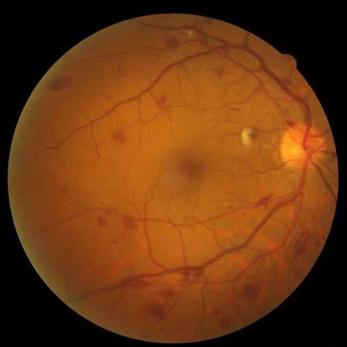 黑龙江省牡丹江林业中 心医院眼科特色项目及技术优势