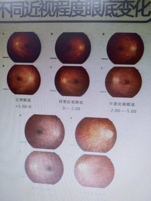 十堰爱尔眼科医院收费价格表/收费标准
