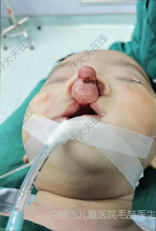 广州军区武汉总医院整形美容中 心医生团队实力强大及骨干医生简介