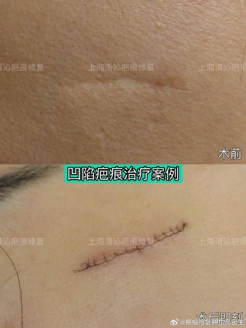 六安伊而美整形美容医生团队实力强大及骨干医生简介