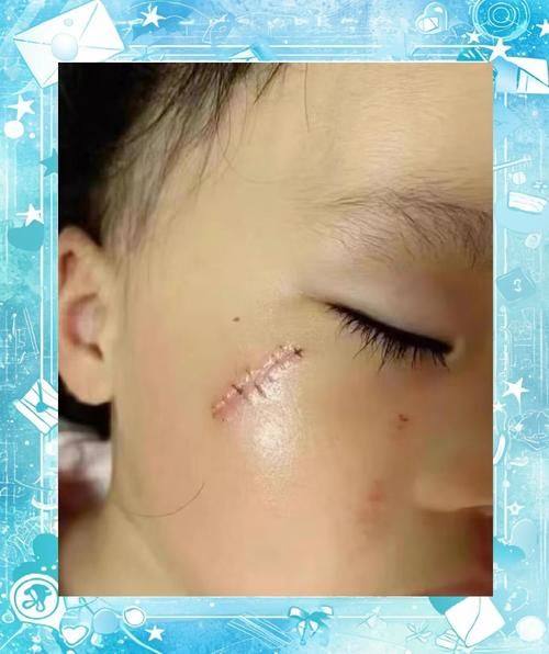 江门市中 心医院创伤烧伤整形科详细的预约挂号方式及流程