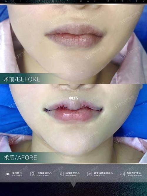 六安伊而美整形美容详细的预约挂号方式及流程