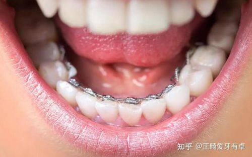 天津共昌爱牙口腔连锁收费价格表/收费标准