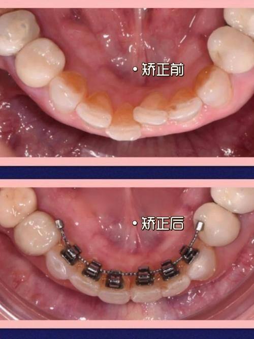 天津共昌爱牙口腔连锁真人口碑评价怎么样？