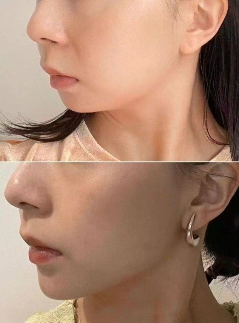 吴亮医生擅长项目