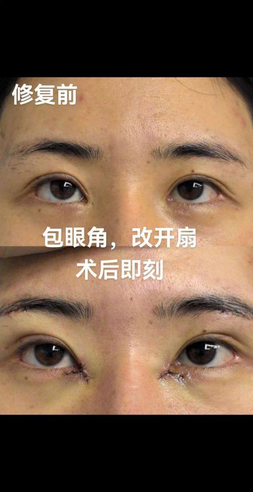 河北沧州红提医疗整形医院特色项目及技术优势