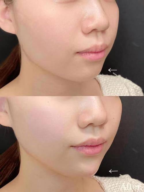 哈尔滨君美施（艺桐）医疗美容门诊部真人口碑评价怎么样？