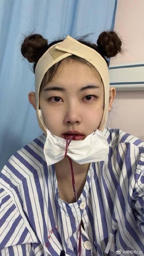 梁亚涵医生口碑评价及真人实例