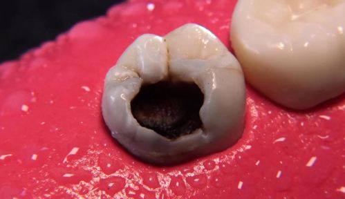 袁惠玲医生口碑评价及真人实例