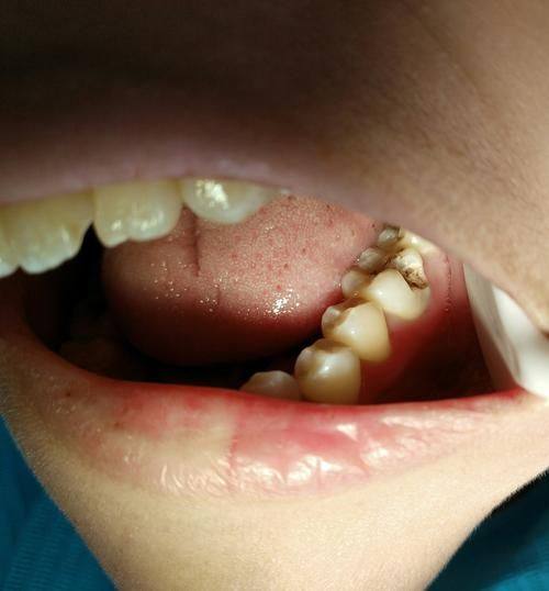 历下诺雅口腔诊所详细的预约挂号方式及流程