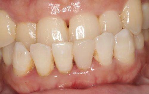 袁惠玲医生坐诊医院