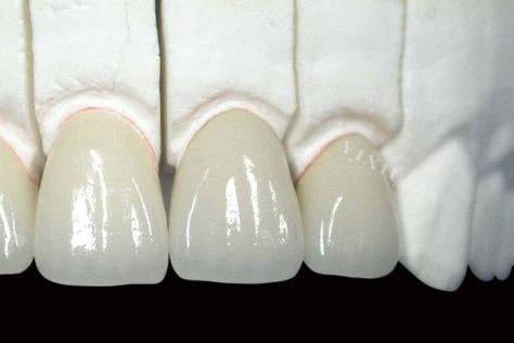 南通如皋丁进明口腔特色项目及技术优势