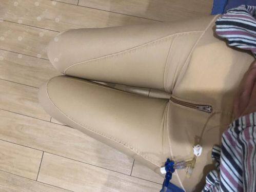 天津熙和医疗美容整形医院真人口碑评价怎么样？