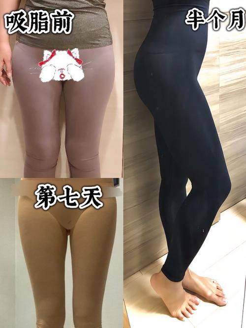 天津熙和医疗美容整形医院收费价格表/收费标准