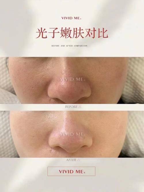 哈尔滨君美施（艺桐）医疗美容门诊部详细的预约挂号方式及流程