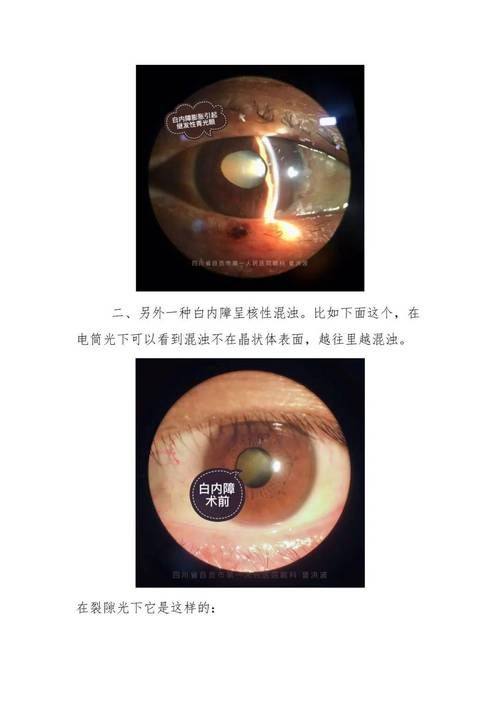 万州爱瑞阳光眼科医院地址电话营业时间