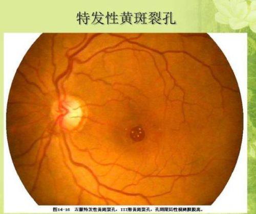 首都医 科 大学附属复兴医院眼科特色项目及技术优势