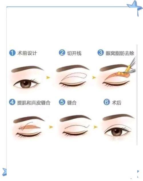 成都武侯艾米丽医疗美容门诊部特色项目及技术优势